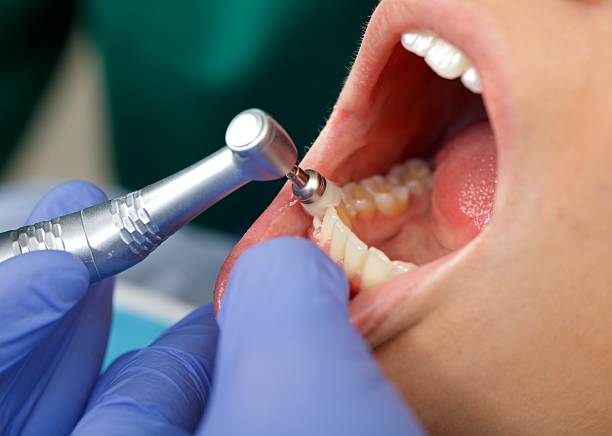 Best Tooth Extraction  in Cedar Springs, MI